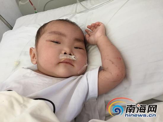 小昌宇躺床上,喊着“妈妈”想吃东西。