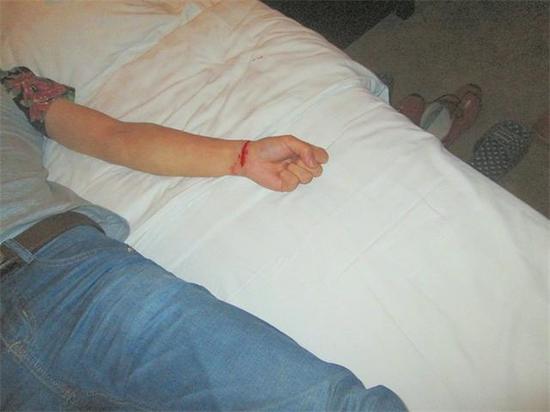 男子自感压力大,深夜割腕自杀,并拍照发给好友