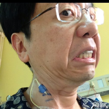 李开复治疗时苦中作乐