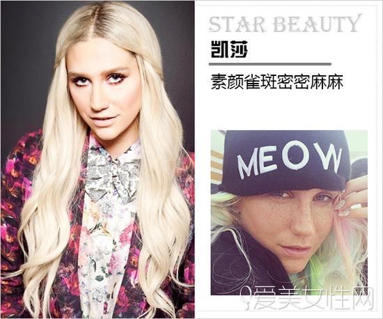 凯莎(Kesha Rose Sebert)