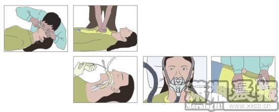 如上图所示，湘雅医院的医生采用了多种方式对王女士进行心肺复苏。 ①人工呼吸②胸外心脏

按压③气管插管④呼吸机辅助呼吸⑤心脏除颤