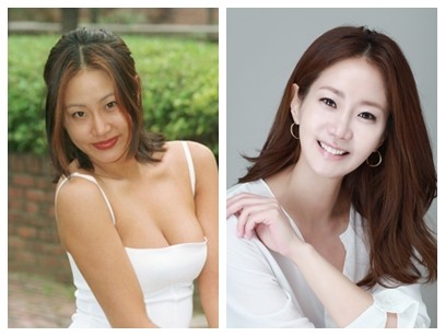 申恩庆整容前后