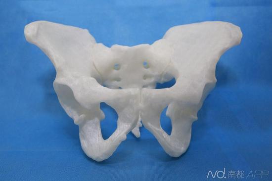 打印出来的骨盆模型。