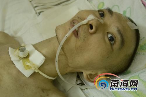 李润富睁着眼睛,一点反应也没有。