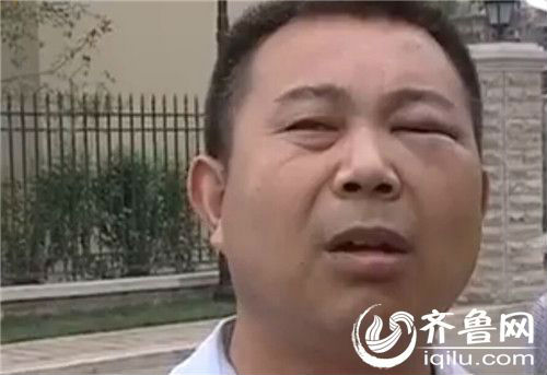 出租车司机蒋师傅眼睛被打青。（视频截图）