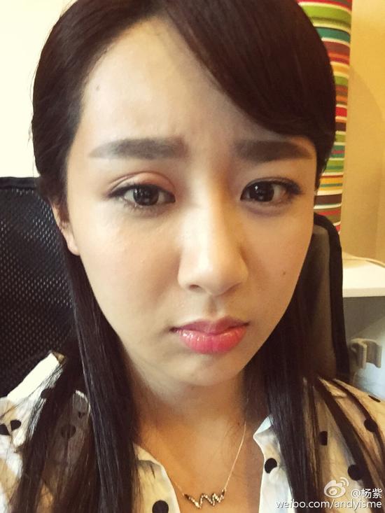 杨紫被蚊子咬眼皮
