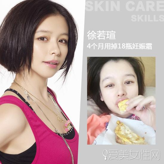 徐若瑄