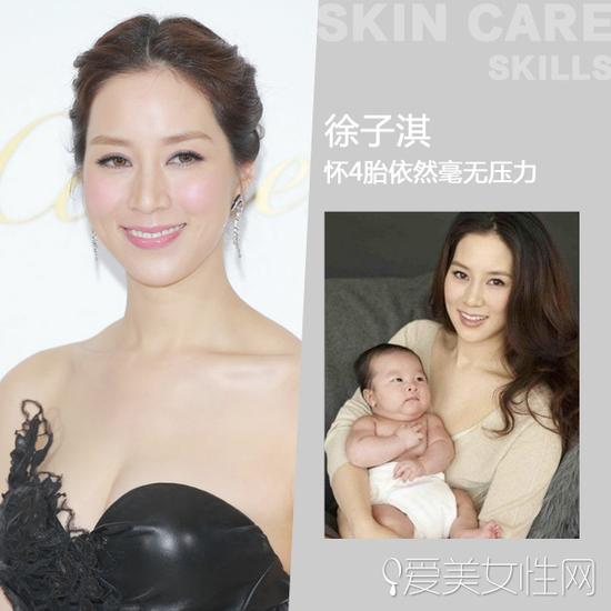 徐子淇