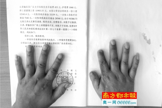 7月24日上午,王洪双手放在判决书上,右手拇指、食指和中指均有不同程度的残损,其中拇指和食指残缺严重。南都记者 孙振飞 摄