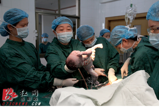 袁劲进院长（右一）为第一例试管婴儿做接生手术 