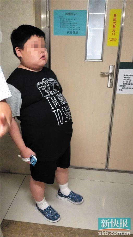 ■15岁的小何身高不达标,体重却有150斤,身患糖尿病、脂肪肝、高血压等病,正在医院接受治疗。