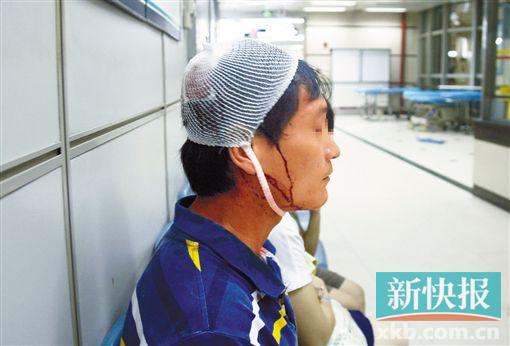 ▲伤者小崔在医院接受治疗。