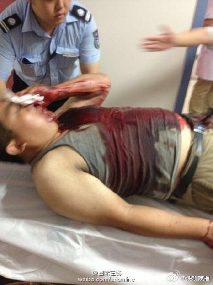 在医院接受救治的消防官兵