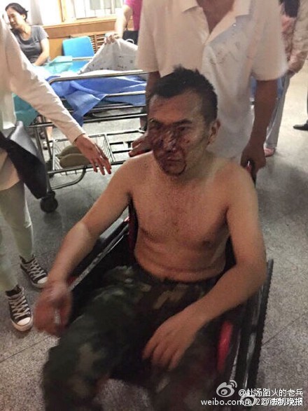 在医院接受救治的消防官兵