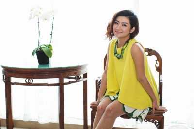 时间是药!Selina和疤痕和平共处|Selina|疤痕|复