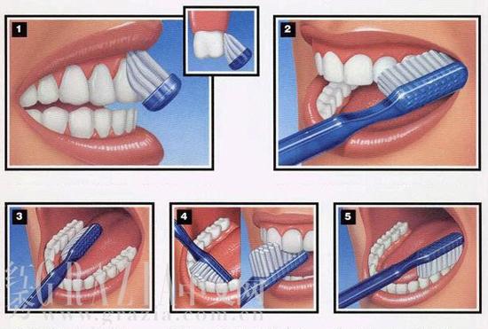 正确刷牙法