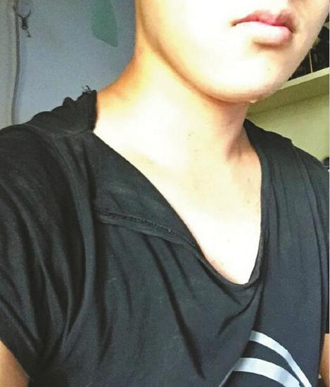 拍攝者衣服被扯爛。(受訪者供圖)