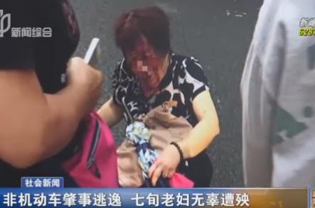 七旬妇遭非机动车撞击多处骨折 肇事司机逃逸高清图片