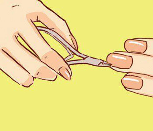 手上长倒刺怎么办?皮肤干燥是长倒刺的主要原