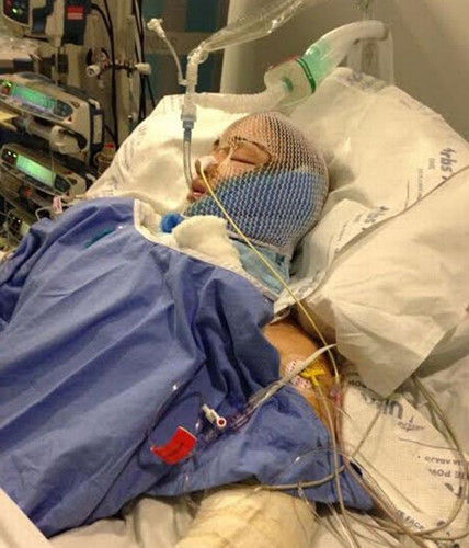因交通意外撞到一棵树,凯莉不但昏迷长达3星期之久,连右脚最终也因严重受伤需截肢