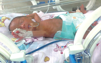 襄城三胞胎姐妹僅有巴掌大 父親望邊打工邊照顧孩子