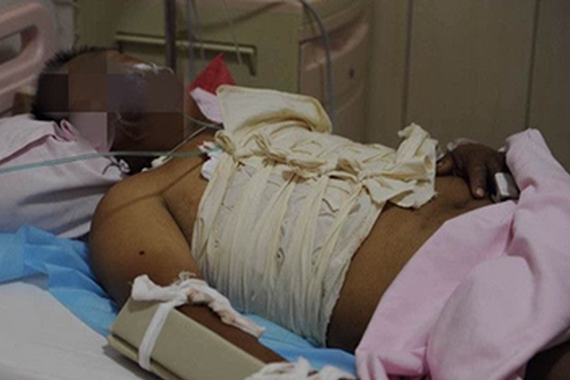 西安面包车与大货车相撞致2人死亡7人受伤