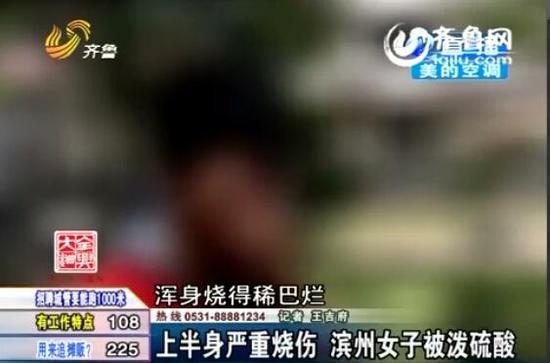 看到媽媽被硫酸燒的樣子,兒子哭了