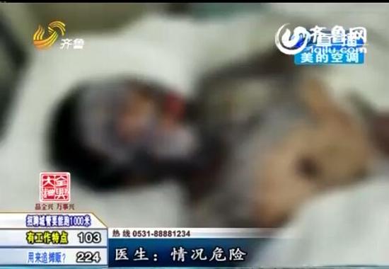 被燒得太慘