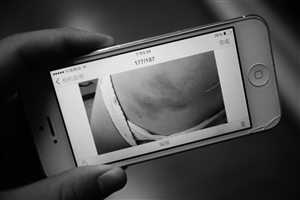 宁波孕妇注射黄体酮后出现不适 全省不少孕妇