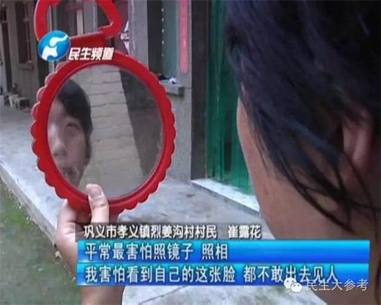 雖說，長相都是娘胎帶。但是，在這個充滿了“顏值+”氣息的時代，要問面孔美不美，賭上人生“試試水”，這不，鞏義市孝義鎮的崔女士，如今就越“試”越后悔。短發、身材消瘦，說話也是輕聲細語，但是每每去找工作，崔女士都處處碰壁。