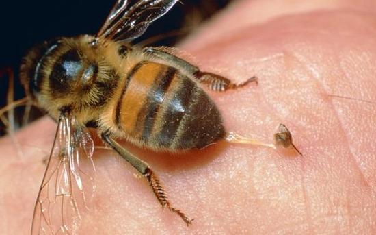 搞笑诺贝尔奖:蜜蜂蛰哪里最疼?|搞笑诺贝尔奖|