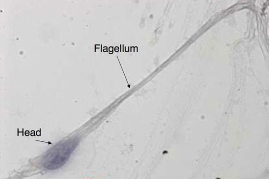早期制作的精子(图片: M-H Perrard,CNRS/Kallistem)