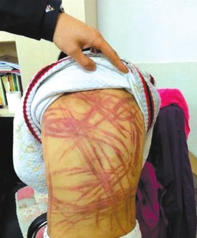 南京虐童案养母认错不认罪 要求重新鉴定孩子