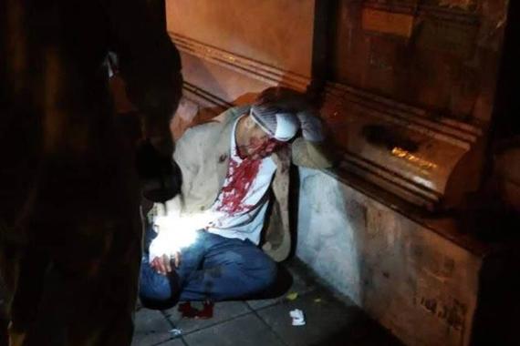 男子醉酒开电车被别 召集人群殴打司机