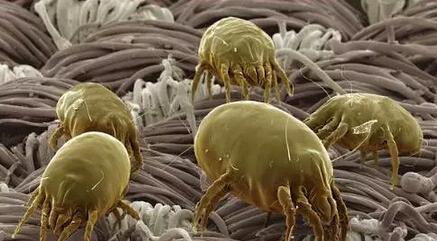 杭州1女生住酒店被螨虫咬伤 医生称螨虫专咬外