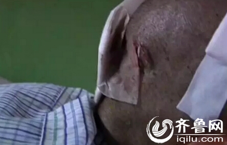 老人遭儿打骂长达19年 手筋断裂脑内有淤血却面临全身瘫痪