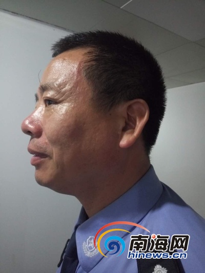 海口美兰交警大队大队长刘建红被打伤的脸尚未消肿,脖子上仍有一些被抓伤的痕迹。(南海网记者周静泊摄)