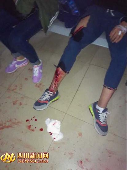 社会青年入校抽烟遇阻后报复 宜宾3中学生被砍