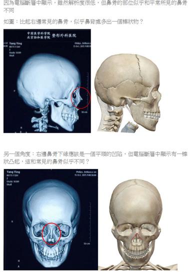 台整型医师质疑杨颖面部鉴定结果