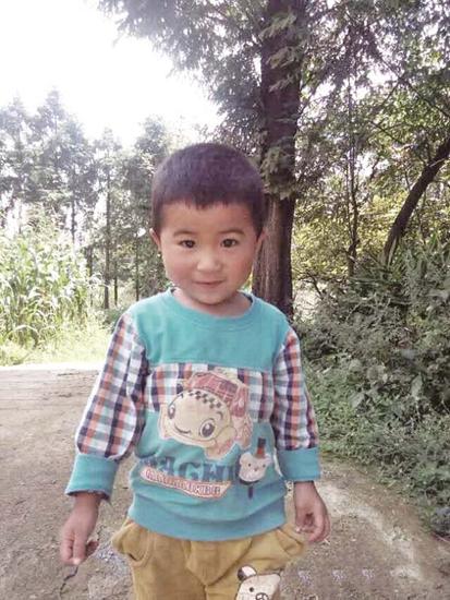 易拉罐火中爆炸重伤男童 前额丢失危及生命