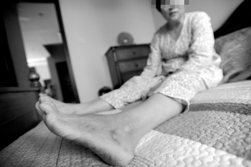 老人左脚没知觉了