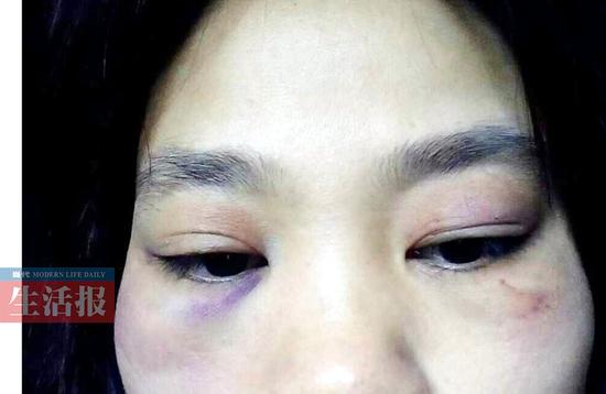 女子不顾家人反对嫁给"体贴"男 婚后被打鼻青脸肿_新浪广西_新浪网