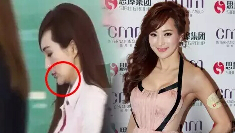 美魔女罗霖下巴变尖走样