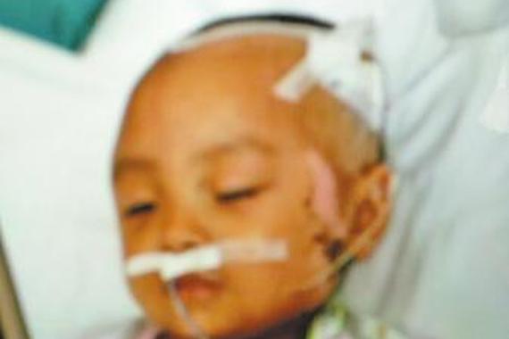 两岁女童被撞重伤 肇事司机有两个身份