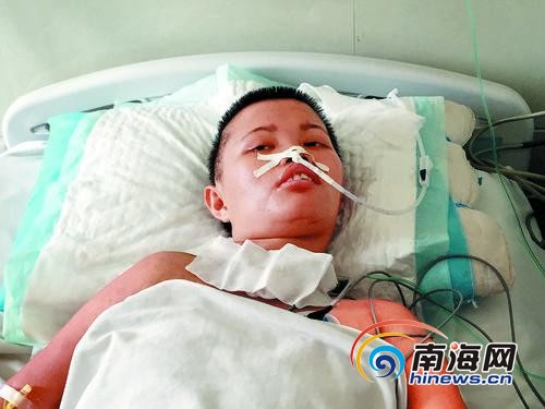 昏迷中的李海珍,有时也会睁开眼。南国都市报记者王洪旭摄