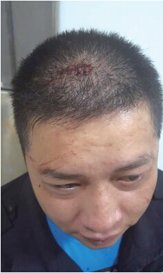 民警头部受伤.