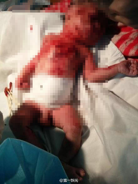 娓崡15宀佸コ瀛╀骇瀛?绔熺敤绔圭鍒洪亶濠村効鍏ㄨ韩鑷充骸