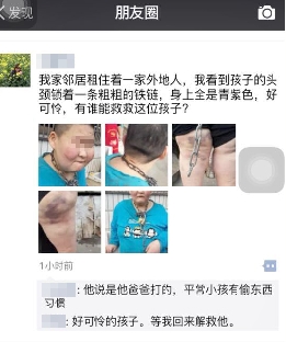 温州15岁少年被家长用粗铁链锁住脖子 只在吃