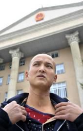 陶先生颈部的伤痕