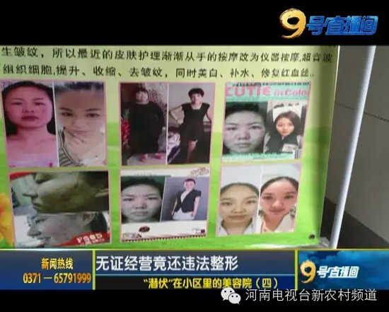 郑州女子美容院注射瘦脸针造成毁容 照片触目惊心